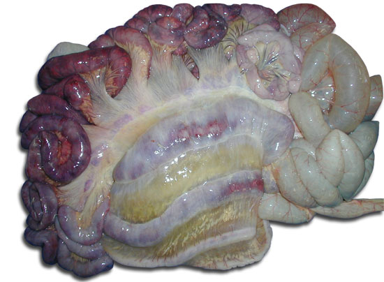 edema mesocolon y serosa del colon debido a C. difficile