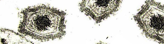 Virus de la Peste porcina africana