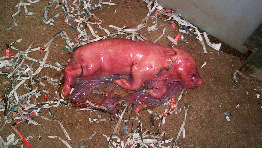 Monitorizaci&oacute;n de partos: Sistemas de control