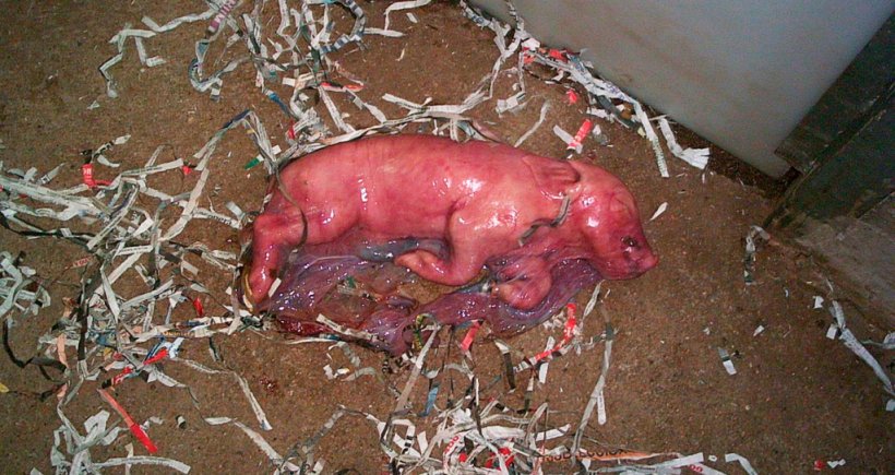 Monitorización de partos: Sistemas de control