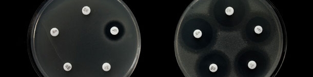 Ejemplo de resistencia a diferentes antibióticos en dos cepas de Salmonella.