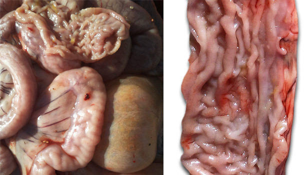 Engrosamiento de la mucosa en parte distal del intestino delgado