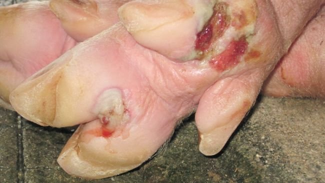 Cojeras y lesiones en los pies de cerdos de engorde
