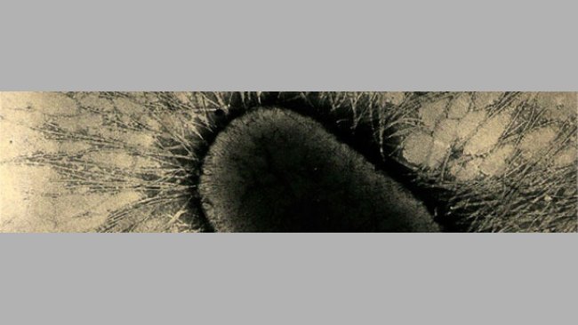 Los factores de adhesión de ETEC son proteínas especializadas de las fimbrias o pilus, que se adhieren fuertemente a los receptores de glicoproteína de las células intestinales