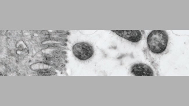 Bacteria ETEC