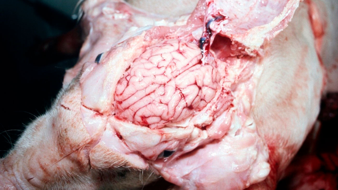 <p>Figura 5. Cerebro visiblemente h&uacute;medo.</p>
