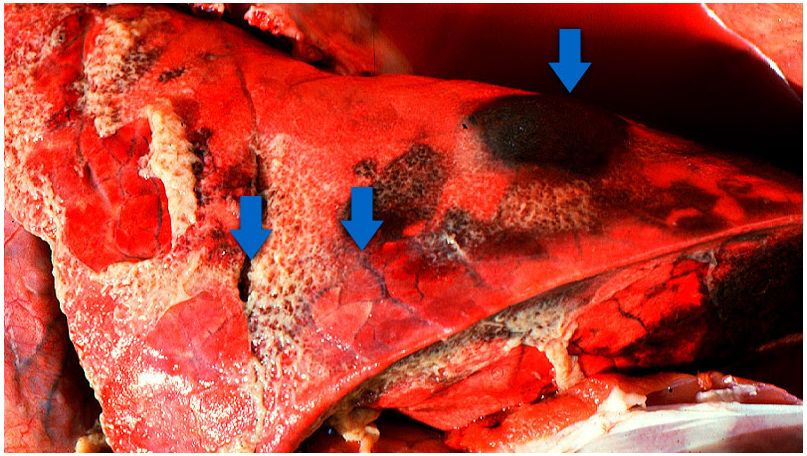 Los tres hallazgos t&amp;iacute;picos de la pleuropneumonia porcina aguda: 1) &amp;aacute;reas consolidadas de color rojo oscuro a negro; 2) edema interlobular y 3) pleuritis fibrinosa. Cortes&amp;iacute;a del Dr Robert Desrosiers
