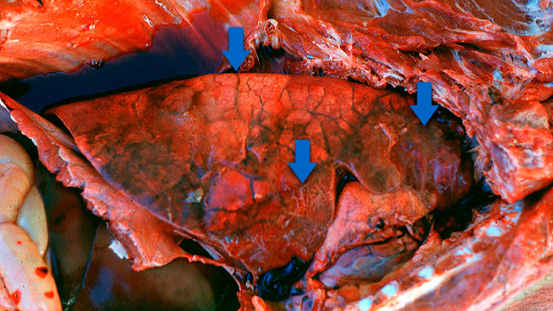 Pleuroneumon&amp;iacute;a aguda en porcino: Normalmente se pueden observar 3 caracter&amp;iacute;sticas (flechas): &amp;aacute;reas consolidadas de color rojo-oscuro a negro, edema interlobular y pleuritis fibrinosa. Foto cortes&amp;iacute;a del Dr Robert Desrosiers.
