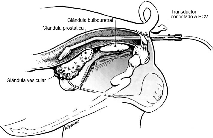 Figura 1: Colocaci&oacute;n del soporte del transductor con el transductor por recto para la visualizaci&oacute;n de gl&aacute;ndulas sexuales accesorias del verraco (Clark &amp; ​​Althouse, 2002).&nbsp;
