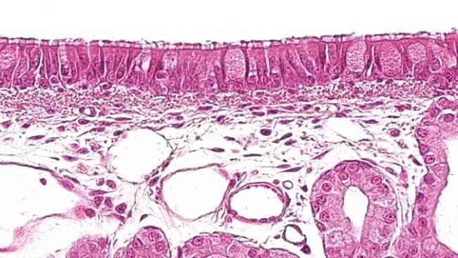 Figura 1: Epitelio seudoestratificado ciliado con células caliciformes característico del aparato respiratorio.