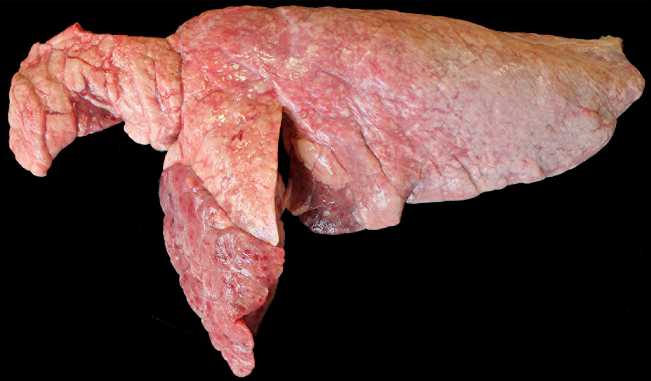 Pulmón de un cerdo coinfectado con M. hyopneumoniae y P. multocida