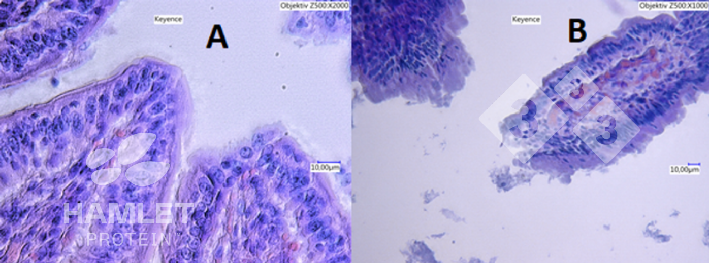 <p>Figura 2. Im&aacute;genes con microscopio electr&oacute;nico de la mucosa intestinal de lechones alimentados con: (A) harina de soja procesada enzim&aacute;ticamente para reducir el contenido de factores antinutricionales&nbsp;(izquierda) y (B)&nbsp;harina de soja convencional (derecha). En la imagen B se aprecian lesiones claras. Im&aacute;genes con copyright de&nbsp;Hamlet Protein.</p>
