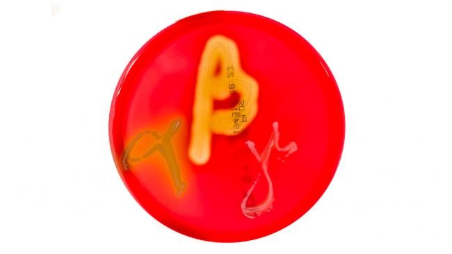Figura&nbsp;1. Cultivos en placas de Petri en agar sangre que muestran hem&oacute;lisis alfa, beta y gamma. Fuente:&nbsp;Mibilehr https://creativecommons.org/licenses/by-sa/4.0/deed.ene&nbsp;
