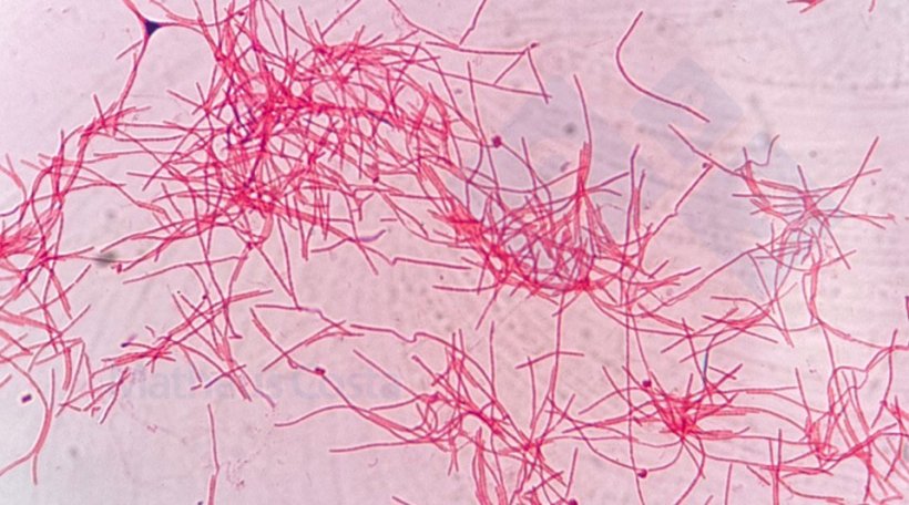 Figura 2. Fusobacterium necrophorum al microscopio.