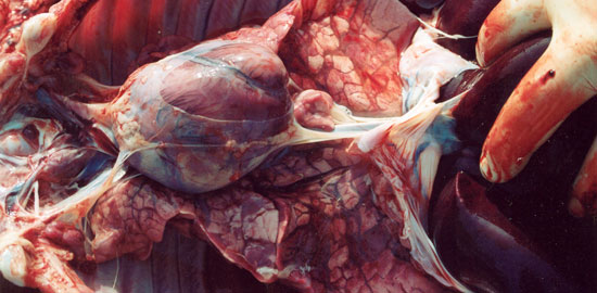 Lesiones pulmonares de tipo B2