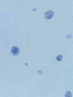 Cantidad ligera de genoma de PCV2 en órganos linfoides
