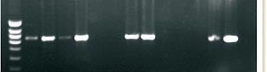 PCR para la detección de DNA de PCV2