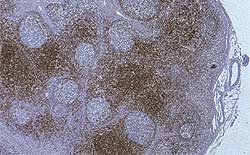 inmunohistoquímica linfocitos T cerdos sanos