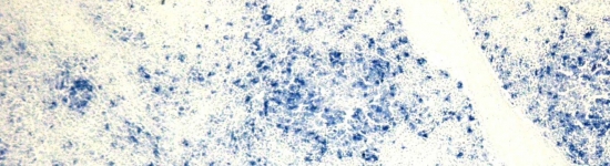 Circovirus