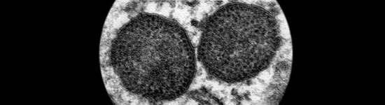 Cuerpos de inclusión en un macrófago