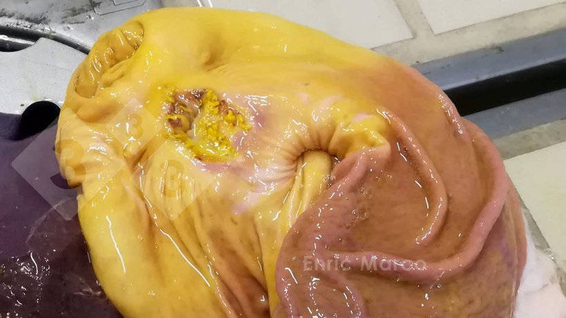 Foto 2. Fase inicial de una úlcera gástrica.