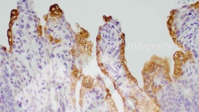 Figura 1. Tinci&oacute;n IHC de DEP en intestino delgado infectado. Fuente: Iowa State University VDL.
