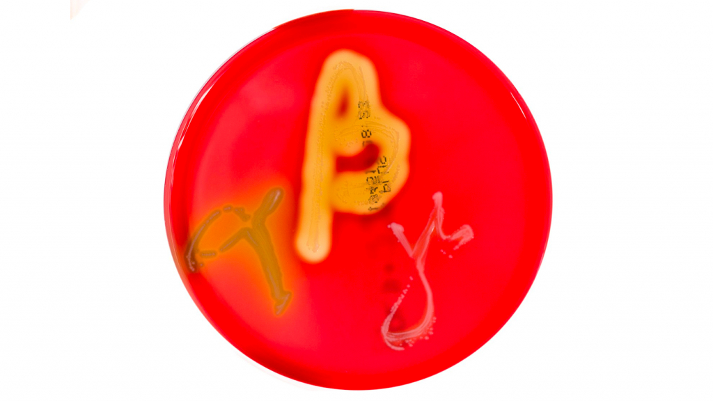 <p>Figura&nbsp;1. Cultivos en placas de Petri en agar sangre que muestran hem&oacute;lisis alfa, beta y gamma. Fuente:&nbsp;Mibilehr https://creativecommons.org/licenses/by-sa/4.0/deed.ene&nbsp;</p>
