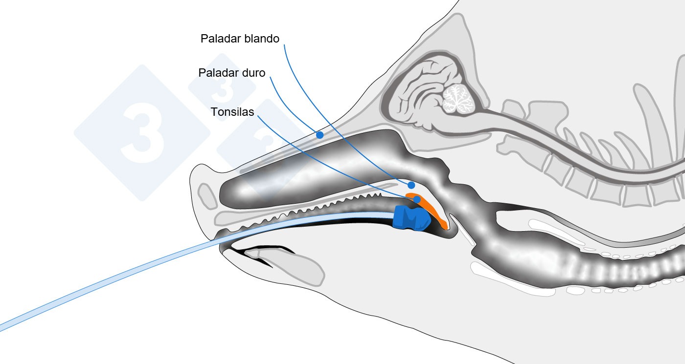 Esquema anatomico señalando el punto de toma de muestra