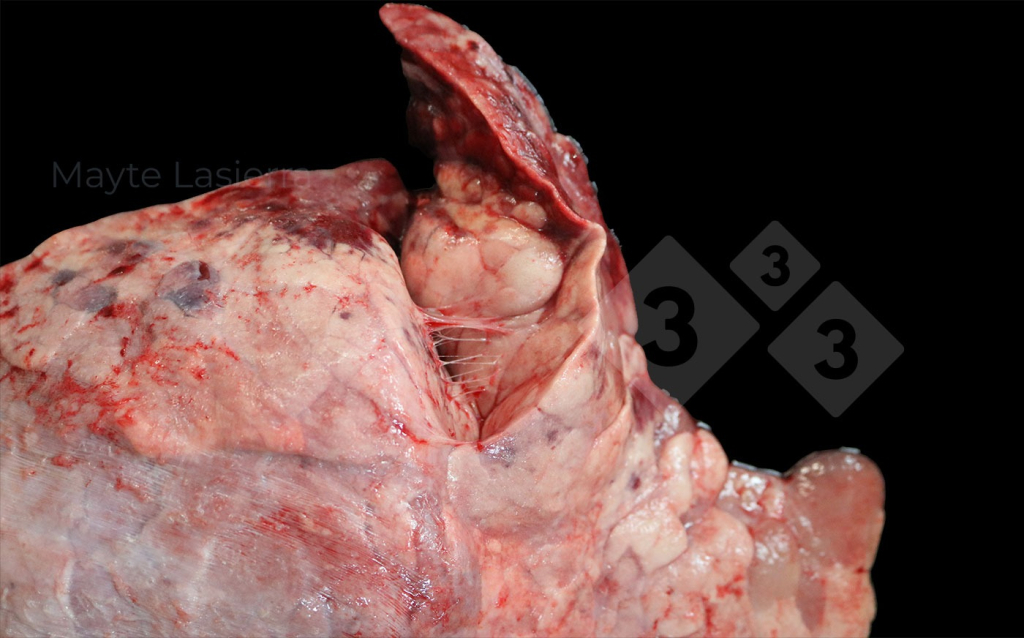 <p>Pleuritis craneal</p>