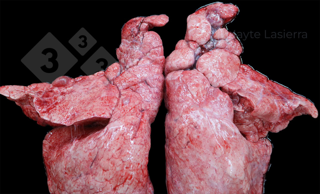<p>Pleuritis craneal</p>