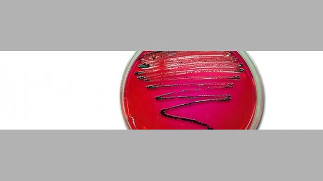 Aislamiento de Salmonella en XLD. En este medio las colonias de salmonella crecen de color negro debido a la producción de ácido sulfhidrico.