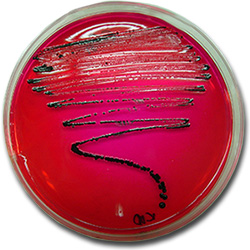Aislamiento de Salmonella en XLD. En este medio las colonias de salmonella crecen de color negro debido a la producción de ácido sulfhidrico.