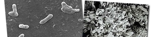 Los agentes causantes de la rinitis atr&oacute;fica: una banda muy organizada