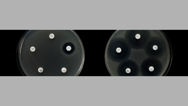 Ejemplo de resistencia a diferentes antibióticos en dos cepas de Salmonella.