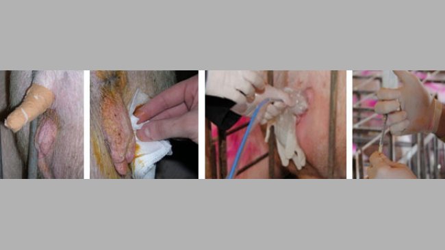 Limpieza cuidadosa de la zona perineal de la receptora e inserción del catéter y de los embriones