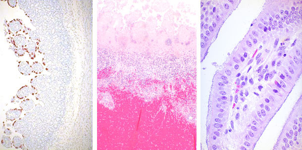 Rotavirus, E.coli y Clostridium perfringens