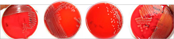 Diferentes morfologías coloniales de aislados de E. coli patógenos