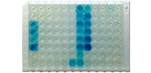 Fotografía de una placa IDEXX ELISA X3 que muestra resultados positivos (color azul) y negativos (sin color)