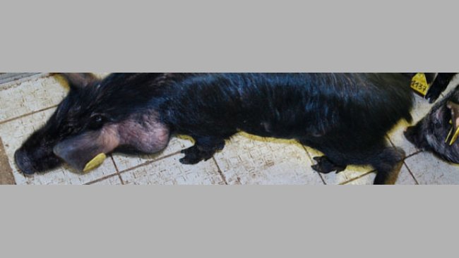 Melanoma y metástasis en linfonodos