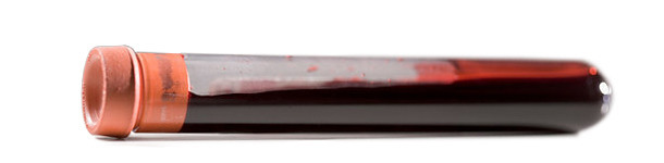 Métodos de detección de lechones PRRSv negativos en reproducciones positivas