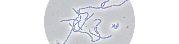 Figura 2. Lactobacillus rhamnosus CTC1679 al microscopio óptico de contraste de fases