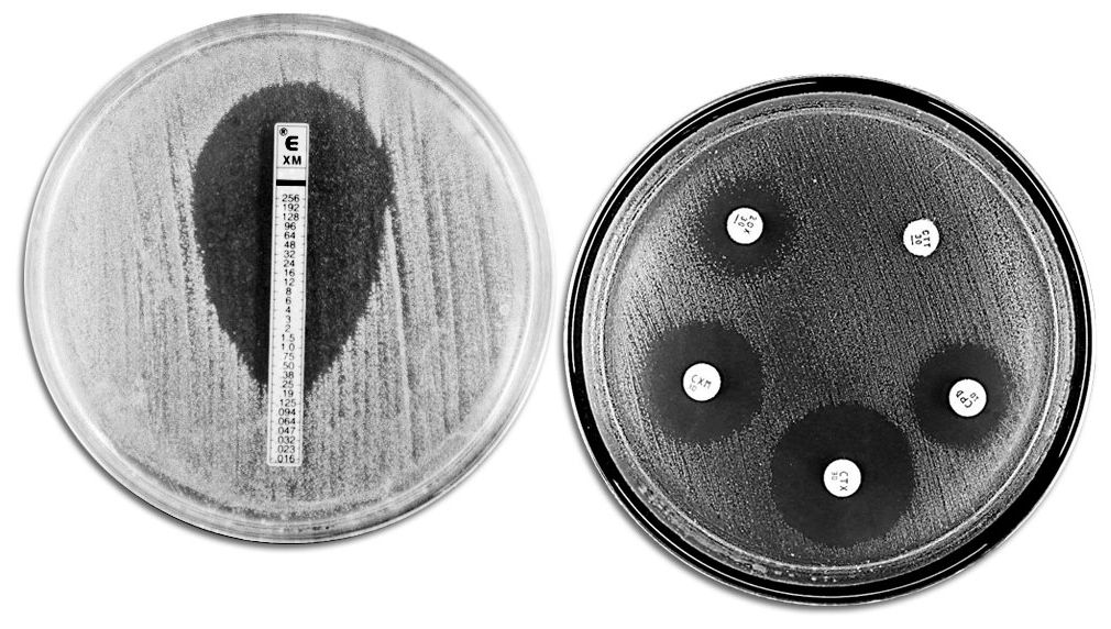 T&eacute;cnicas cl&aacute;sicas de evaluaci&oacute;n de la resistencia a antibi&oacute;ticos. A la izquierda se muestra un E-TEST que permite medir la concentraci&oacute;n m&iacute;nima de antibi&oacute;tico que impide el crecimiento bacteriano. A la derecha se muestra un antibiograma en el que se observan diferentes halos de inhibici&oacute;n del crecimiento por parte de los antibi&oacute;ticos.
