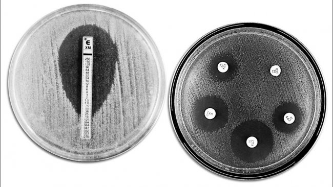 T&eacute;cnicas cl&aacute;sicas de evaluaci&oacute;n de la resistencia a antibi&oacute;ticos. A la izquierda se muestra un E-TEST que permite medir la concentraci&oacute;n m&iacute;nima de antibi&oacute;tico que impide el crecimiento bacteriano. A la derecha se muestra un antibiograma en el que se observan diferentes halos de inhibici&oacute;n del crecimiento por parte de los antibi&oacute;ticos.
