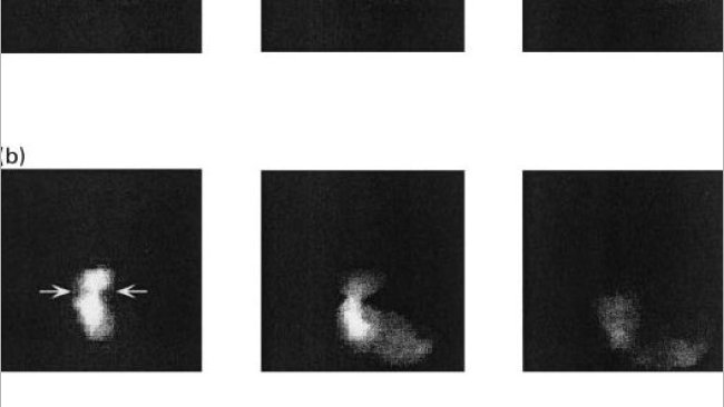 Figura 1. Imágenes del vaciado gástrico en cerdos alimentados con una dieta basada en almidón (a), pulpa de remolacha (b) y salvado de trigo a los 10, 60 y 120 minutos post-ingestión (Fuente: Guerin et al., 2001).