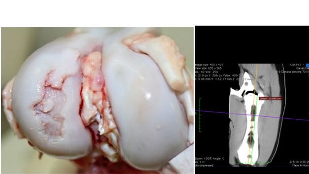 Vista macrosc&oacute;pica de la articulaci&oacute;n de la rodilla con una lesi&oacute;n severa de osteocondrosis en el c&oacute;ndilo lateral del f&eacute;mur.
