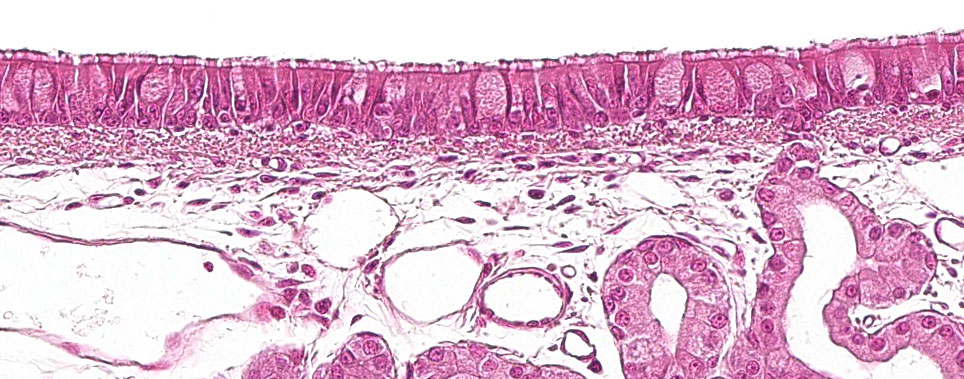 Epitelio seudoestratificado ciliado con células caliciformes característico del aparato respiratorio