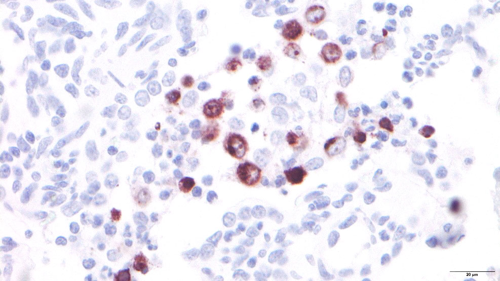 Macrófagos alveolares infectados por el PRRSV