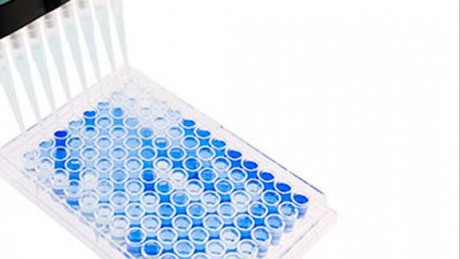 Imagen 1. Plato de ELISA de fondo plano con 96 pocillos usado para serolog&iacute;a de PRRSV. Las muestras positivas se muestran en azul. Fuente: Base Pair Biotechnologies.
