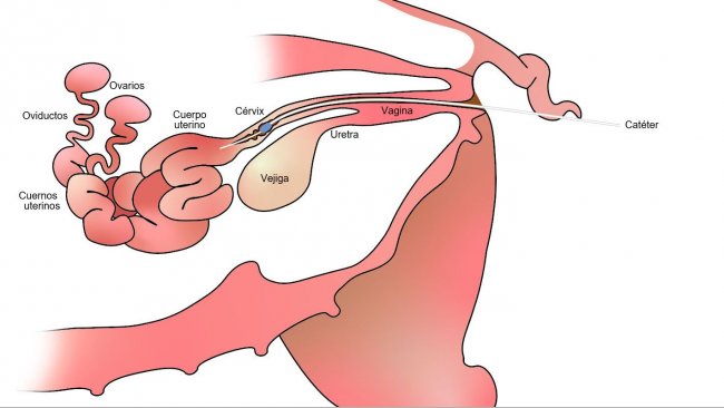 Imagen 1. En la inseminaci&oacute;n artificial postcervial el semen se deposita en el cuerpo del &uacute;tero, despu&eacute;s del c&eacute;rvix.
