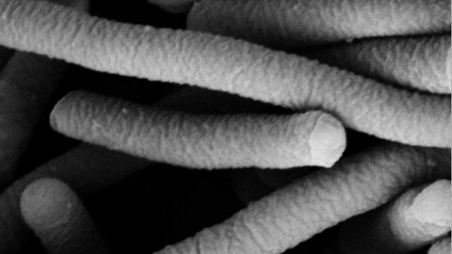 Foto 1. Micrograf&iacute;a electr&oacute;nica de Lactobacillus acidophilus, que tiene caracter&iacute;sticas probi&oacute;ticas. Foto de Mogana Das Murtey y Patchamuthu Ramasamy.
